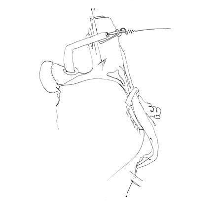 Relevés anatomiques, y-axis par Nicolas Terrasson